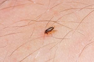 kill fleas naturally